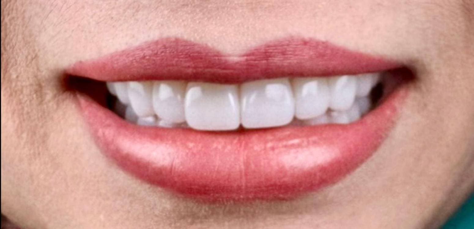 After dental treatment