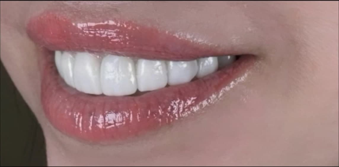 After dental treatment