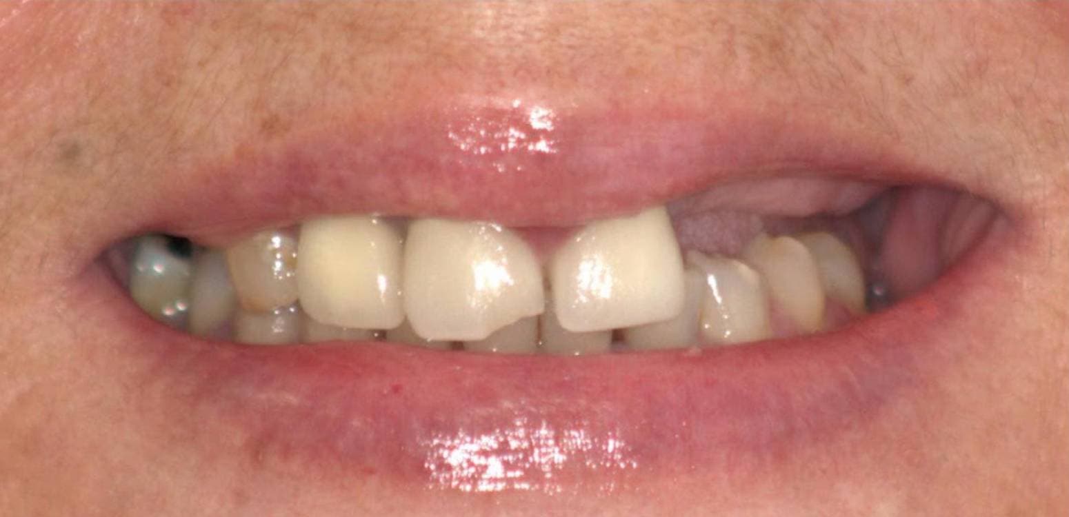 Before dental treatment