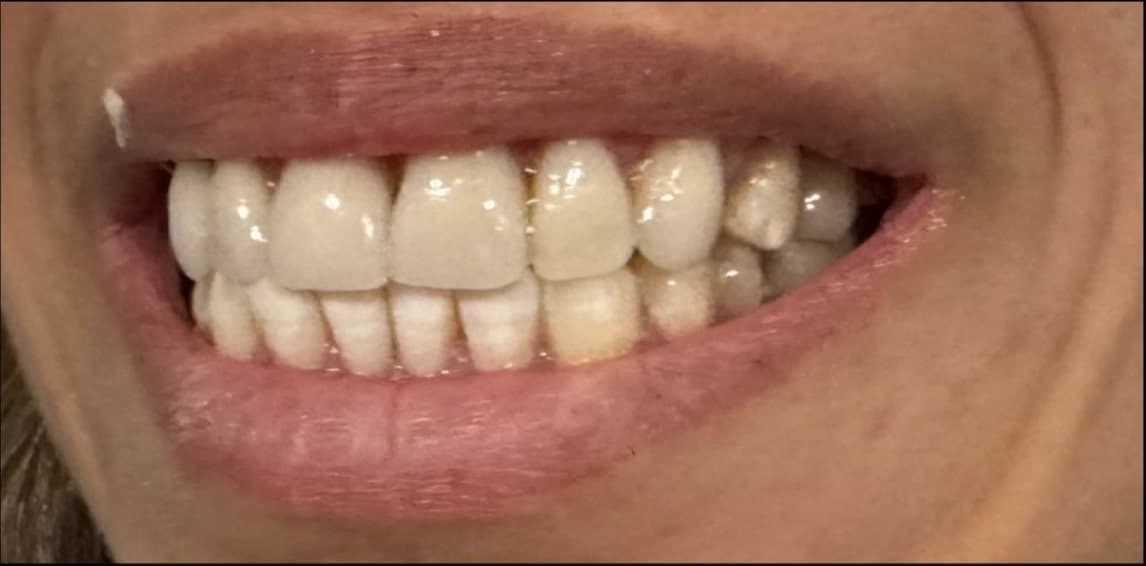 Before dental treatment