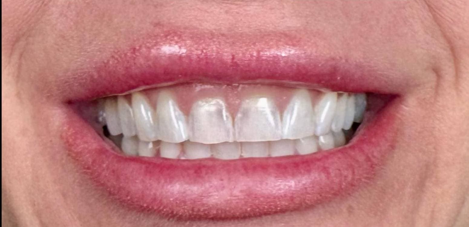 Before dental treatment