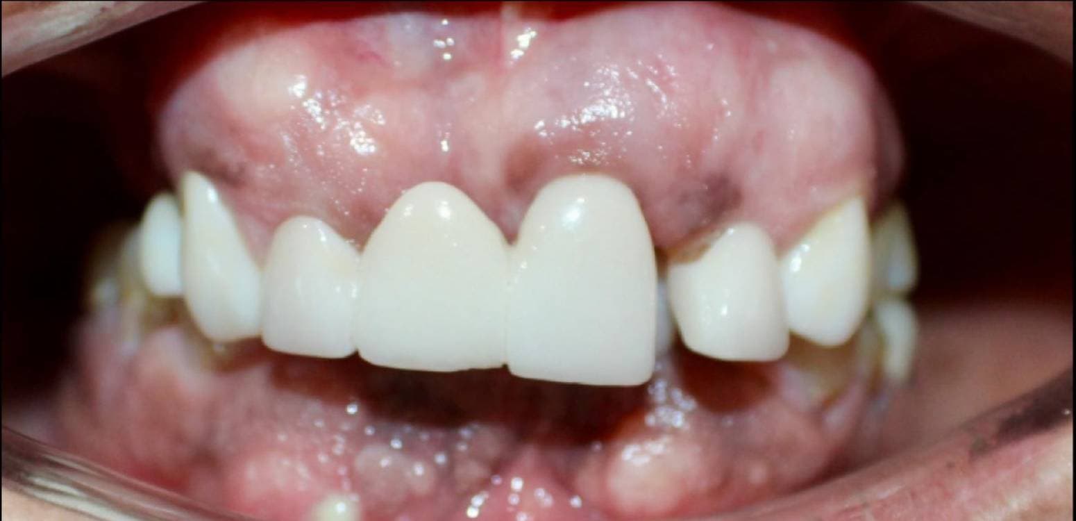 Before dental treatment