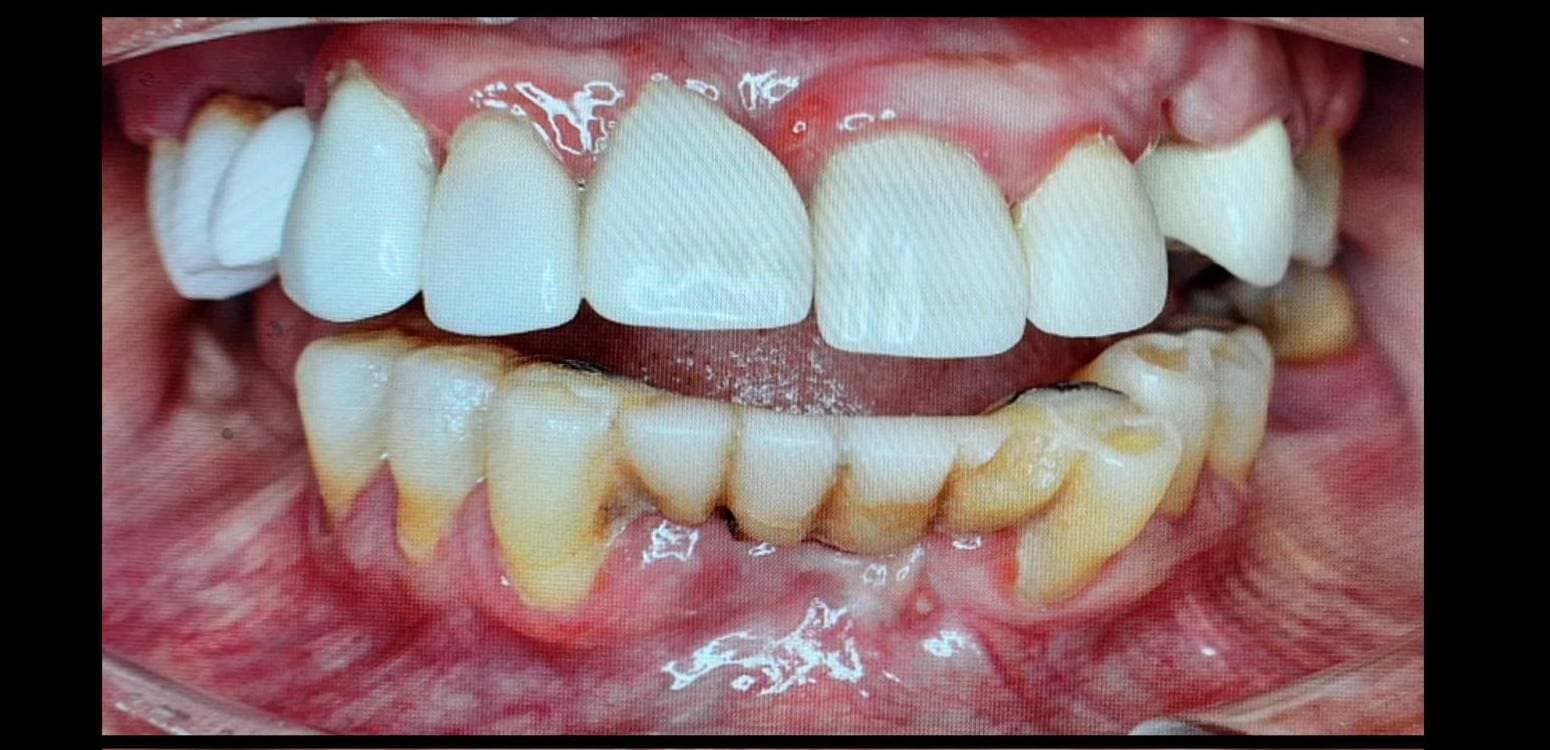 Before dental treatment